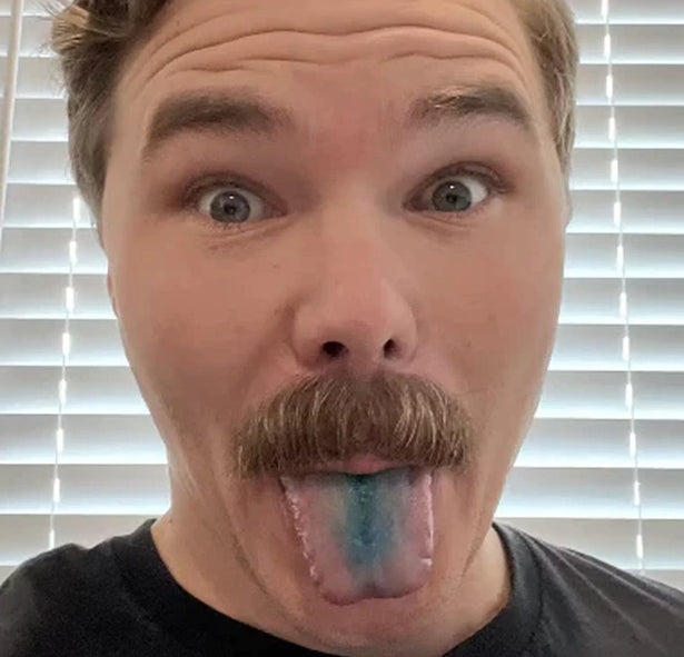 Customer showing blue tongue after methylene blue