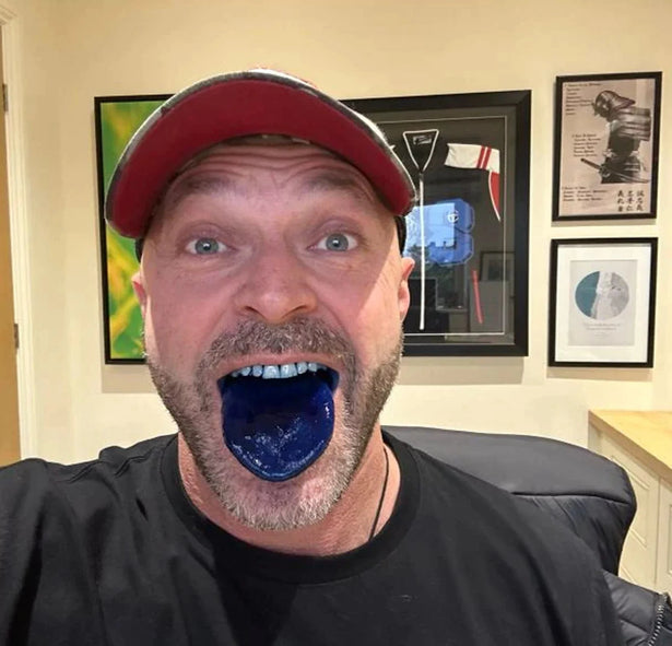 Customer showing blue tongue after methylene blue